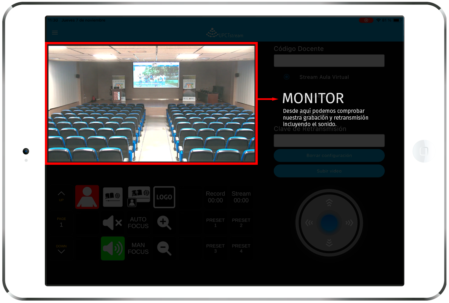 Monitor