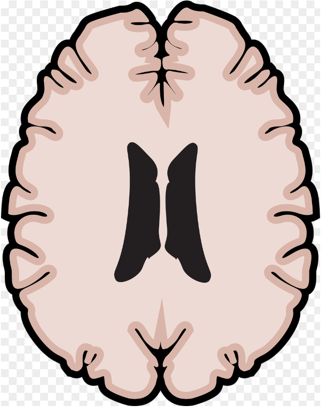 MRI
